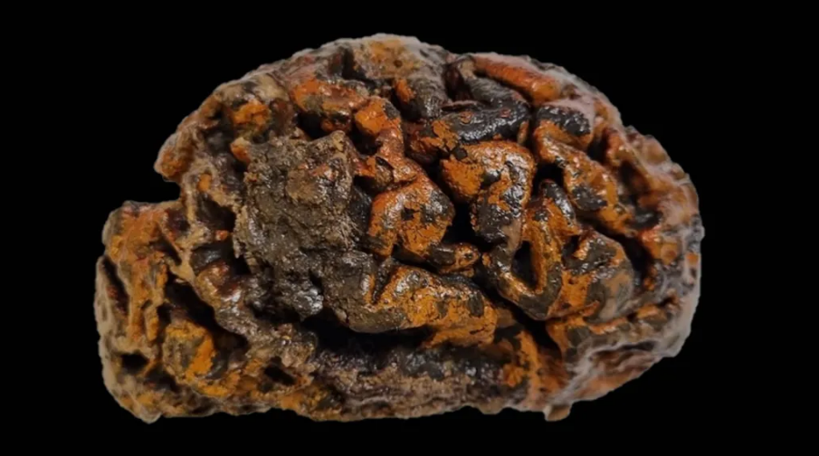 1,000-year-old brain